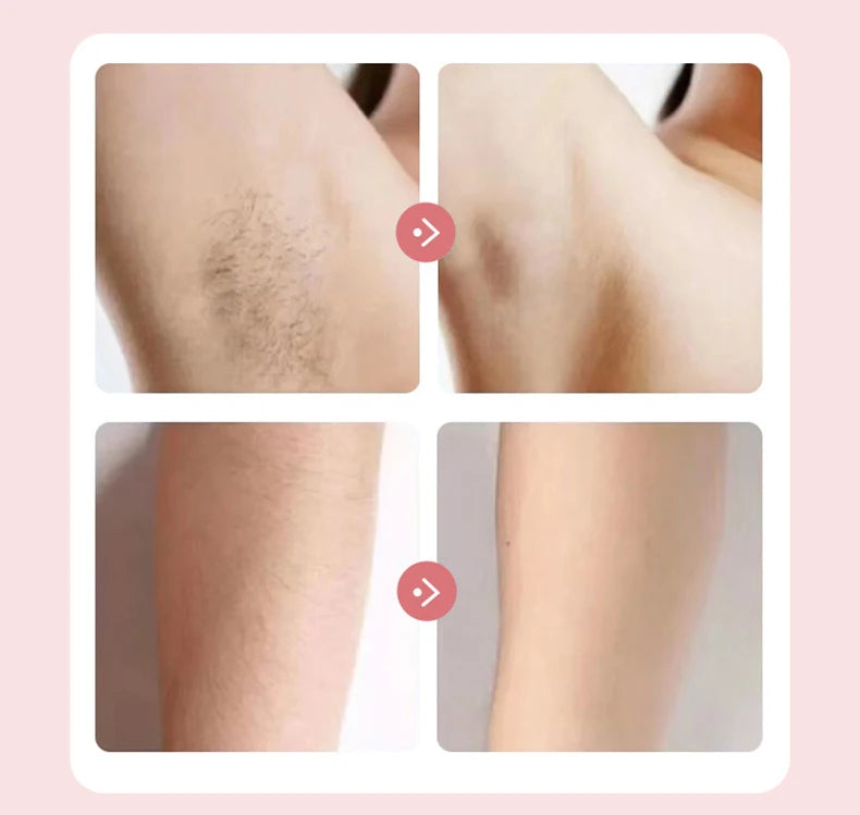 Nuvexpro – Épilateur Électronique 2-en-1 Indolore pour femmes.